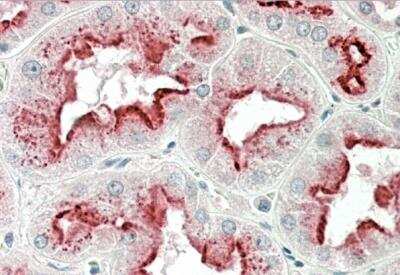 Immunohistochemistry-Paraffin: Apolipoprotein D Antibody [NBP2-42526]