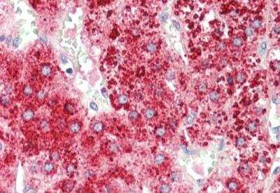 Immunohistochemistry-Paraffin: Apolipoprotein D Antibody [NBP2-42526]