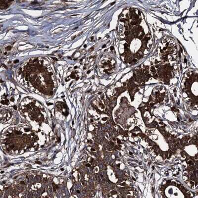 Immunohistochemistry-Paraffin: Apolipoprotein D Antibody [NBP2-57684]