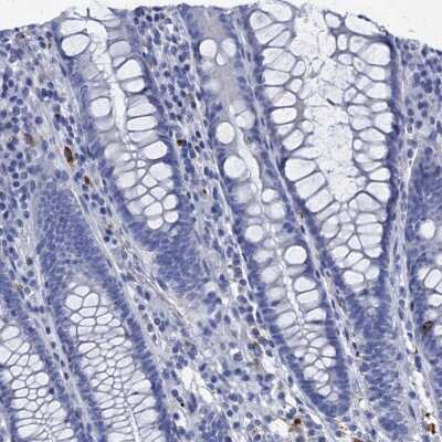Immunohistochemistry-Paraffin: Apolipoprotein D Antibody [NBP2-57684]