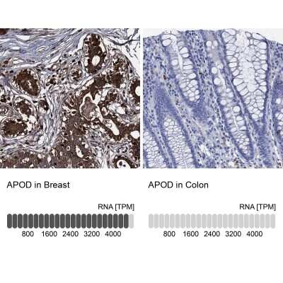 Immunohistochemistry-Paraffin: Apolipoprotein D Antibody [NBP2-57684]