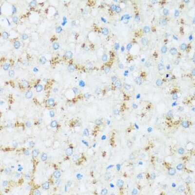 Immunohistochemistry-Paraffin: Apolipoprotein D Antibody - Azide and BSA Free [NBP3-03576]