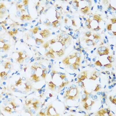 Immunohistochemistry-Paraffin: Apolipoprotein D Antibody - Azide and BSA Free [NBP3-03576]