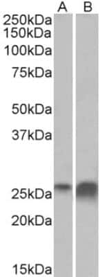 Western Blot: Apolipoprotein D Antibody [NBP2-42512]