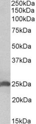 Western Blot: Apolipoprotein D Antibody [NBP2-42526]