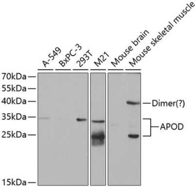 Western Blot: Apolipoprotein D AntibodyBSA Free [NBP2-92650]