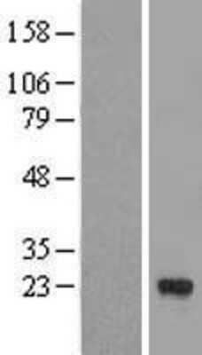 Western Blot: Apolipoprotein D Overexpression Lysate [NBL1-07620]