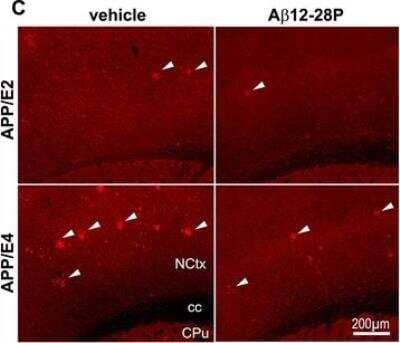 Immunohistochemistry: Apolipoprotein E/ApoE Antibody (3D12) [NBP1-97424]