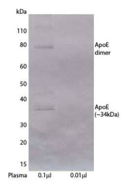 Western Blot: Apolipoprotein E/ApoE Antibody (E981) [NBP3-18297]