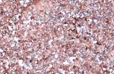 Immunohistochemistry-Paraffin: Apolipoprotein E/ApoE Antibody - BSA Free [NBP1-31123]