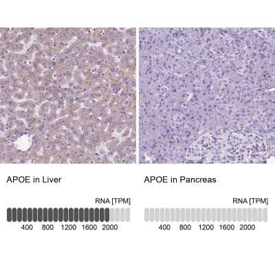 Immunohistochemistry-Paraffin: Apolipoprotein E/ApoE Antibody [NBP2-49450]