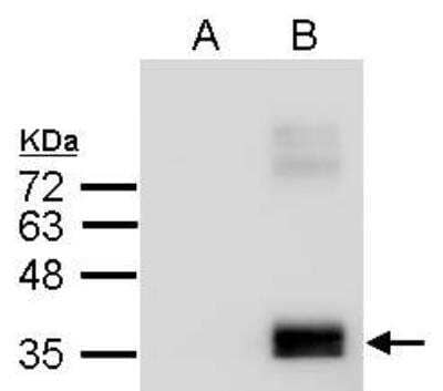 Western Blot: Apolipoprotein E/ApoE AntibodyBSA Free [NBP1-31123]