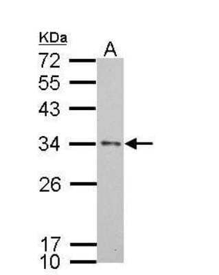 Western Blot: Apolipoprotein E/ApoE AntibodyBSA Free [NBP1-31123]