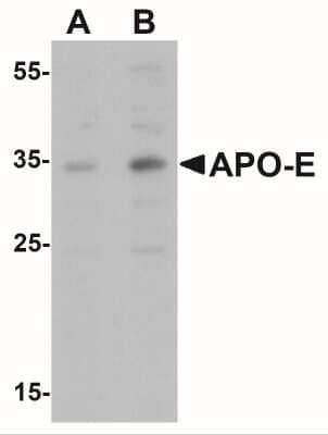 Western Blot: Apolipoprotein E/ApoE AntibodyBSA Free [NBP2-41216]