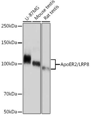 Western Blot: Apolipoprotein E R2/ApoE R2 Antibody (0V1R8) [NBP3-16872]