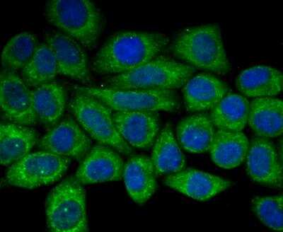 Immunocytochemistry/ Immunofluorescence: Apolipoprotein E R2/ApoE R2 Antibody [NBP2-76911]