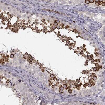 Immunohistochemistry-Paraffin: Apolipoprotein E R2/ApoE R2 Antibody [NBP2-62680]