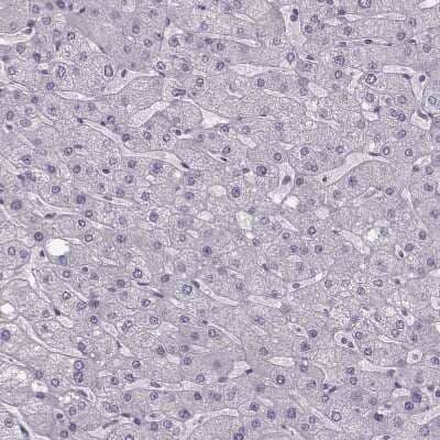Immunohistochemistry-Paraffin: Apolipoprotein E R2/ApoE R2 Antibody [NBP2-62680]