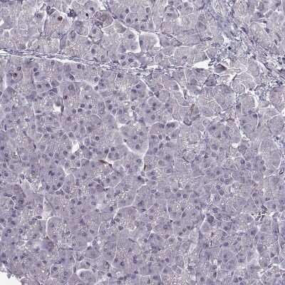 Immunohistochemistry-Paraffin: Apolipoprotein E R2/ApoE R2 Antibody [NBP2-62680]
