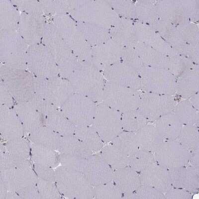 Immunohistochemistry-Paraffin: Apolipoprotein E R2/ApoE R2 Antibody [NBP2-62680]