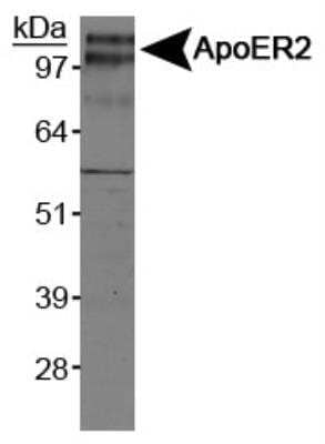 Western Blot: Apolipoprotein E R2/ApoE R2 Antibody [NB100-2216]