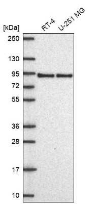 Western Blot: Apolipoprotein E R2/ApoE R2 Antibody [NBP2-62680]