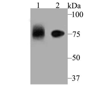 Western Blot: Apolipoprotein E R2/ApoE R2 Antibody [NBP2-76911]