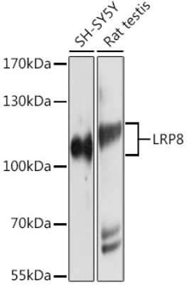 Western Blot: Apolipoprotein E R2/ApoE R2 AntibodyBSA Free [NBP2-92026]