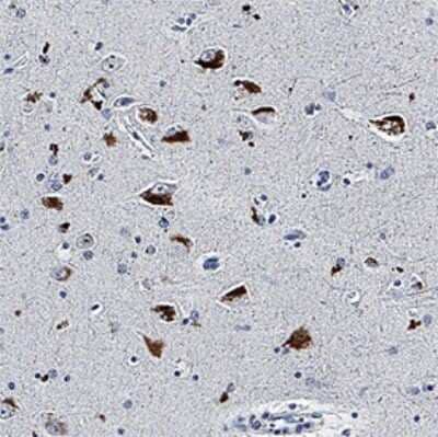 Immunohistochemistry: Apolipoprotein E/ApoE Antibody (960319) - Azide and BSA Free [MAB41442]