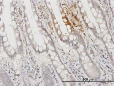 Immunohistochemistry-Paraffin: Apolipoprotein F Antibody (1D5) [H00000319-M02]