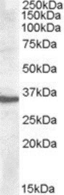 Western Blot: Apolipoprotein F Antibody [NBP1-20882]