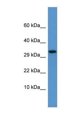 Western Blot: Apolipoprotein F Antibody [NBP1-69070]