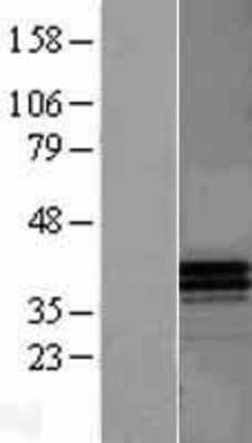 Western Blot: Apolipoprotein F Overexpression Lysate [NBL1-07622]