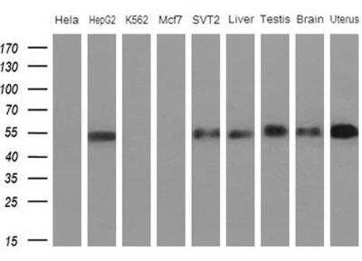 Western Blot: Apolipoprotein H/ApoH Antibody (OTI4A11) [NBP2-46534]