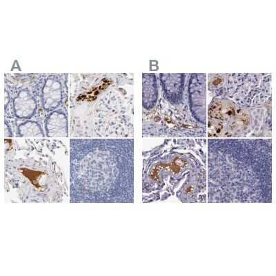 Immunohistochemistry-Paraffin: Apolipoprotein H/ApoH Antibody [NBP1-90045]