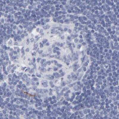 Immunohistochemistry-Paraffin: Apolipoprotein H/ApoH Antibody [NBP1-90045]