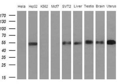 Western Blot: Apolipoprotein H/ApoH Antibody (OTI4A11)Azide and BSA Free [NBP2-70186]