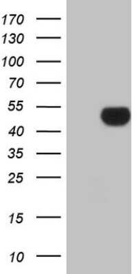 Western Blot: Apolipoprotein H/ApoH Antibody (OTI4A11)Azide and BSA Free [NBP2-70186]