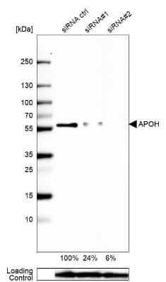 Western Blot: Apolipoprotein H/ApoH Antibody [NBP1-90045]