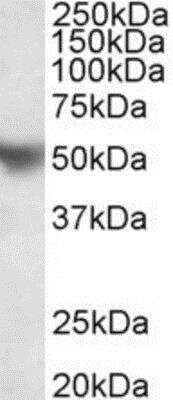 Western Blot: Apolipoprotein H/ApoH Antibody [NBP1-97764]