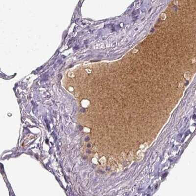 Immunohistochemistry-Paraffin: Apolipoprotein L1 Antibody (CL0171) [NBP2-14785]