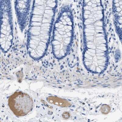 Immunohistochemistry-Paraffin: Apolipoprotein L1 Antibody [NBP1-89033]