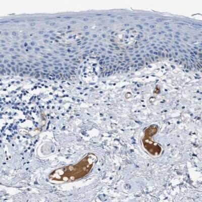 Immunohistochemistry-Paraffin: Apolipoprotein L1 Antibody [NBP1-89033]