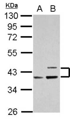 Western Blot: Apolipoprotein L1 Antibody [NBP2-15430]