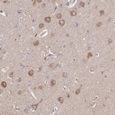 Immunohistochemistry-Paraffin: Apolipoprotein L2 Antibody [NBP1-90127]