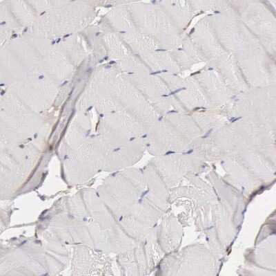 Immunohistochemistry-Paraffin: Apolipoprotein L2 Antibody [NBP1-90127]