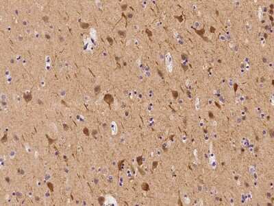 Immunohistochemistry-Paraffin: Apolipoprotein L2 Antibody [NBP2-98660]