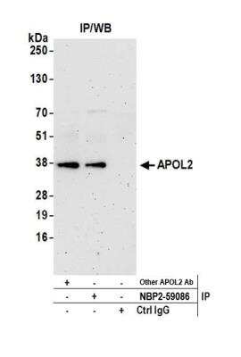 Immunoprecipitation: Apolipoprotein L2 Antibody [NBP2-59086]