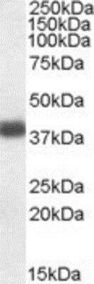 Western Blot: Apolipoprotein L2 Antibody [NBP1-06978]