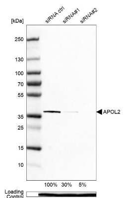 Western Blot: Apolipoprotein L2 Antibody [NBP1-90127]